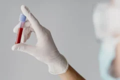 Doenças do sangue: sinais precoces e a importância do diagnóstico