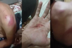 Família denuncia policiais por tortura com faca e martelo no interior do Ceará