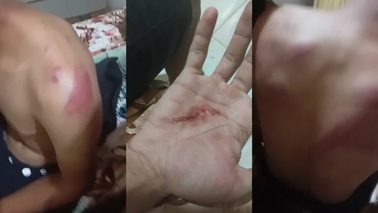 Família denuncia policiais por tortura com faca e martelo no interior do Ceará