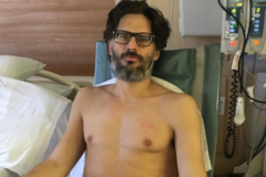 Joe Manganiello detalha luta contra doença misteriosa e revela cirurgias graves em desabafo