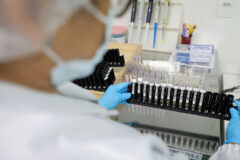 Malária: Anvisa libera testes em humanos de vacina 100% brasileira