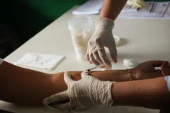 Ministério Público Federal investiga testes de tuberculose no Acre