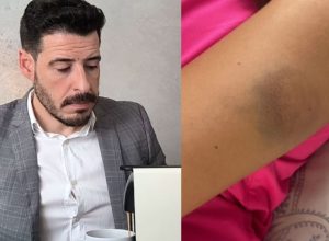 Thiago Schutz, à esquerda; foto da agressão no corpo da vítima, à direita  • Reprodução