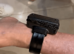 O ex-presidente Jair Bolsonaro afirmou que queimou tornozeleira com ferro de solda “por curiosi...