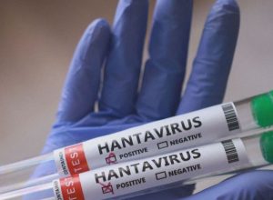 Tubos de ensaio com amostrar do hantavírus, que atingiu um cruzeiro de luxo  • REUTERS